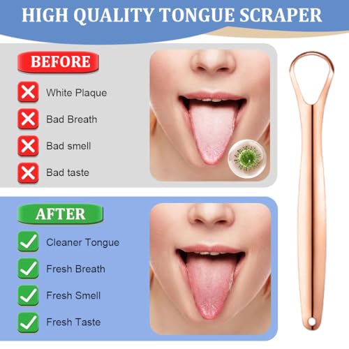 HASTHIP® Tongue Scrapers Set of 3Pcs Tongue Cleaning Scrapers for Kids Adults Stainless Steel Tongue Scrapers with Travel Case Oral Cleaning Tongue Scrapers