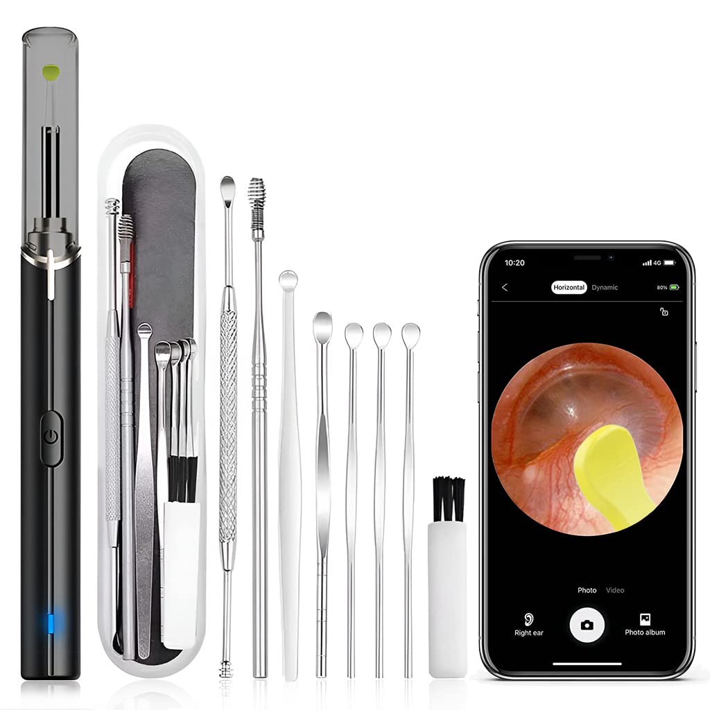 HD LED Ear Camera Otoscope – Ear Wax Removal Tool With Pick Set For Kids & Adults, 360° View