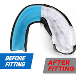 HASTHIP® outh Guard for Braces for Adults & Youth, Sports Football, Boxing & MMA, Dental Protection, Comfortable Fit, Customizable, Durable, Clear, Single Pack