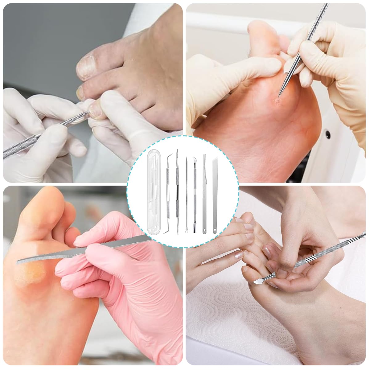 HASTHIP®6-Piece Toenail Care Kit