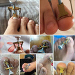 HASTHIP® 6PCS Toe Nail Correction Tool Pedicure Tool + Ingrown Toe Nail Lifter + Stainless Steel Nail Clipper/Nipper