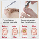 HASTHIP® 6-Piece Wide Jaw Nail Clipper Kit